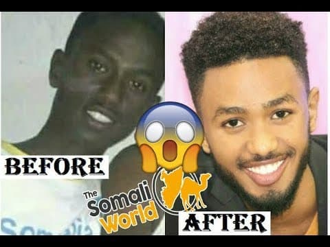 DAAWO SAWIRADA BEFORE IYO AFTER EE FANAANINTA 2018